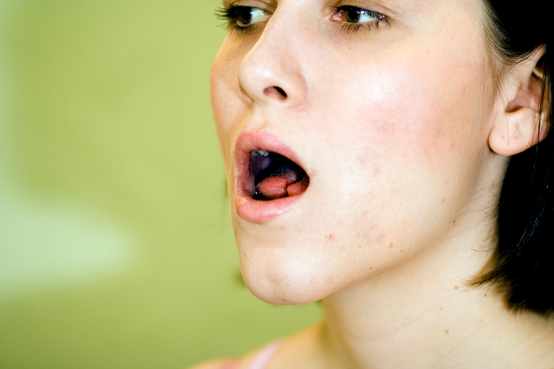 Tongue_5